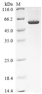 Greater than 90% as determined by SDS-PAGE.Recombinant Human Interleukin-12 Receptor Subunit Beta-1 (IL12RB1) Protein (His)