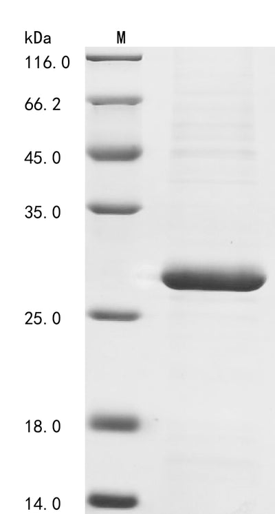 Greater than 85% as determined by SDS-PAGE.Recombinant Human Cytokine Receptor Common Subunit Gamma (IL2RG) Protein (His)