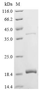 Greater than 90% as determined by SDS-PAGE.Recombinant Bovine Insulin (INS) Protein (His-KSI)