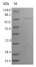Greater than 90% as determined by SDS-PAGE.Recombinant Human Inositol Hexakisphosphate Kinase 1 (IP6K1) Protein (His-SUMO)