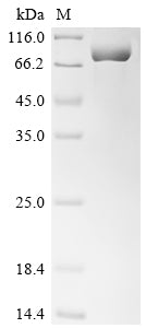 Greater than 90% as determined by SDS-PAGE.Recombinant Human Interleukin-1 Receptor-Associated Kinase-Like 2 (IRAK2) Protein (His)