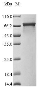 Greater than 90% as determined by SDS-PAGE.Recombinant Mouse Interleukin-1 Receptor-Associated Kinase 3 (IRAK3) Protein (His&Myc)