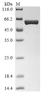 Greater than 90% as determined by SDS-PAGE.Biotinylated Recombinant Human Insulin Receptor Substrate 1 (IRS1) Protein (MBP&His-Avi)