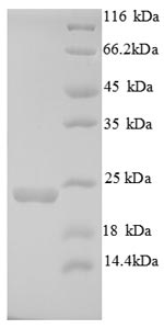 Greater than 90% as determined by SDS-PAGE.