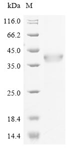 Greater than 90% as determined by SDS-PAGE.Recombinant Human Integrin Alpha-M (ITGAM) Protein (His-GST)