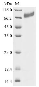 Greater than 85% as determined by SDS-PAGE.Recombinant Human Integrin Beta-7 (ITGB7) Protein (His)