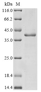 Greater than 85% as determined by SDS-PAGE.Recombinant Human Integrin Beta-7 (ITGB7) Protein (GST)