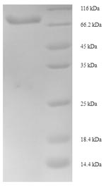 Greater than 90% as determined by SDS-PAGE.Recombinant Human Inositol-Trisphosphate 3-Kinase B (ITPKB) Protein (His-SUMO)