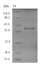 Greater than 90% as determined by SDS-PAGE.Recombinant Human Tyrosine-Protein Kinase Jak1 (JAK1) Protein (His)