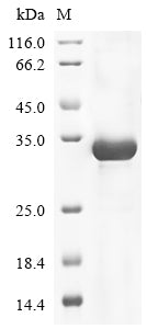 Greater than 85% as determined by SDS-PAGE.Recombinant Human Anosmin-1 (ANOS1) Protein (His)