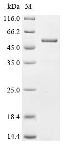 Greater than 90% as determined by SDS-PAGE.Recombinant Human Katanin P60 Atpase-Containing Subunit A1 (KATNA1) Protein (His&Myc)