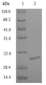 Greater than 90% as determined by SDS-PAGE.Recombinant Human Potassium Voltage-Gated Channel Subfamily A Member 1 (KCNA1) Protein (His)