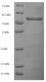 Greater than 90% as determined by SDS-PAGE.Recombinant Human Voltage-Gated Potassium Channel Subunit Beta-2 (KCNAB2) Protein (His-SUMO)