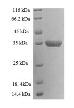 Greater than 90% as determined by SDS-PAGE.