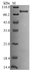 Greater than 85% as determined by SDS-PAGE.Recombinant Humankelch-Like Ech-Associated Protein 1 (KEAP1) Protein (His-SUMO)