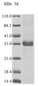 Greater than 85% as determined by SDS-PAGE.Recombinant Mouse Ketohexokinase (KHK) Protein (His)