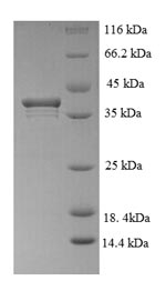 Greater than 90% as determined by SDS-PAGE.Recombinant Human Pcna-Associated Factor (PCLAF) Protein (GST)