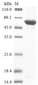 Greater than 85% as determined by SDS-PAGE.Recombinant Human Kynurenine 3-Monooxygenase (KMO) Protein (His)