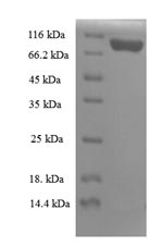 Greater than 90% as determined by SDS-PAGE.Recombinant Mouse Importin Subunit Beta-1 (KPNB1) Protein (His)
