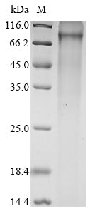 Greater than 85% as determined by SDS-PAGE.Recombinant Mouse Keratinocyte Proline-Rich Protein (KPRP) Protein (His)