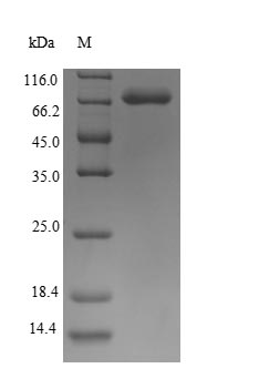 Greater than 90% as determined by SDS-PAGE.Recombinant Human Keratin, Type I Cytoskeletal 10 (KRT10) Protein (His)