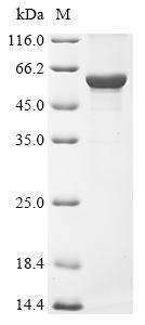 Greater than 85% as determined by SDS-PAGE.Recombinant Human Keratin, Type I Cytoskeletal 16 (KRT16) Protein (His&Myc)