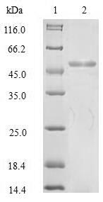 Greater than 85% as determined by SDS-PAGE.Recombinant Human Keratin, Type I Cytoskeletal 18 (KRT18) Protein (His)