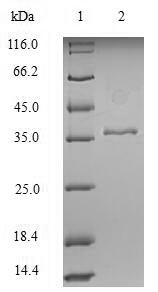 Greater than 90% as determined by SDS-PAGE.Recombinant Human Keratin, Type I Cytoskeletal 18 (KRT18) Protein (His)