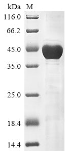 Greater than 85% as determined by SDS-PAGE.Recombinant Human Keratin, Type I Cytoskeletal 18 (KRT18)