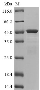 Greater than 85% as determined by SDS-PAGE.Recombinant Human Keratin, Type I Cytoskeletal 19 (KRT19) Protein (His)
