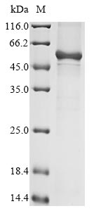 Greater than 85% as determined by SDS-PAGE.Recombinant Human Keratin, Type I Cuticular Ha4 (KRT34) Protein (His&Myc)
