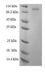 Greater than 90% as determined by SDS-PAGE.Recombinant Human Keratin, Type Ii Cytoskeletal 6A (KRT6A) Protein (GST)