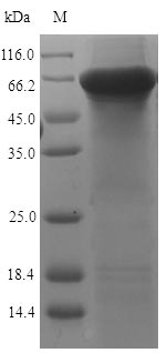 Greater than 90% as determined by SDS-PAGE.Recombinant Human Keratin, Type Ii Cytoskeletal 7 (KRT7) Protein (His-SUMO)