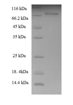 Greater than 90% as determined by SDS-PAGE.Recombinant Human Keratin, Type Ii Cytoskeletal 8 (KRT8) Protein (His-SUMO)
