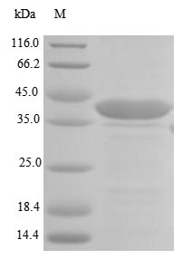 Greater than 85% as determined by SDS-PAGE.Recombinant Human Laminin Subunit Beta-1 (LAMB1) Protein (His-SUMO)