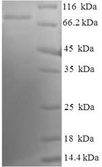 Greater than 90% as determined by SDS-PAGE.Recombinant Human Tyrosine-Protein Kinase Lck (LCK) Protein (His-SUMO)