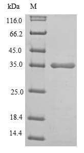 Greater than 85% as determined by SDS-PAGE.Recombinant Human L-Lactate Dehydrogenase A Chain (LDHA)