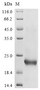 Greater than 90% as determined by SDS-PAGE.Recombinant Mouse Leukocyte Cell-Derived Chemotaxin-2 (LECT2) Protein (His)