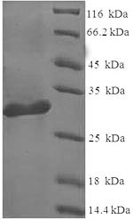 Greater than 90% as determined by SDS-PAGE.Recombinant Human Galectin-1 (LGALS1) Protein (His-SUMO)
