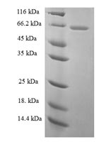 Greater than 90% as determined by SDS-PAGE.Recombinant Rat Galectin-3-Binding Protein (LGALS3BP) Protein (His)
