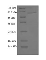 Greater than 90% as determined by SDS-PAGE.Recombinant Mouse Galectin-6 (LGALS6) Protein (GST)