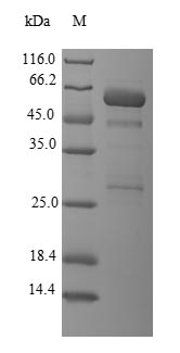 Greater than 90% as determined by SDS-PAGE.Recombinant Human Galectin-8 (LGALS8) Protein (GST), Active