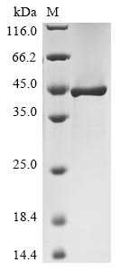 Greater than 90% as determined by SDS-PAGE.Recombinant Human Leucine-Rich Glioma-Inactivated Protein 1 (LGI1) Protein (His&Myc)