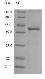 Greater than 90% as determined by SDS-PAGE.Recombinant Mouse Legumain (LGMN) Protein (His)