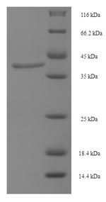 Greater than 90% as determined by SDS-PAGE.Recombinant Human Lutropin-Choriogonadotropic Hormone Receptor (LHCGR) Protein (His)