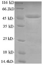 Greater than 90% as determined by SDS-PAGE.Recombinant Human Lysosomal Acid Lipase/Cholesteryl Ester Hydrolase (LIPA) Protein (GST)
