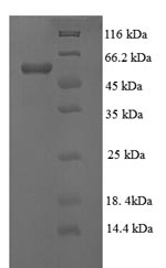 Greater than 90% as determined by SDS-PAGE.Recombinant Human Lysyl Oxidase Homolog 1 (LOXL1) Protein (His)