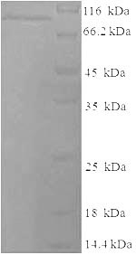Greater than 90% as determined by SDS-PAGE.Recombinant Mouse Lysyl Oxidase Homolog 2 (LOXL2) Protein (His)