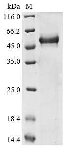 Greater than 85% as determined by SDS-PAGE.Recombinant Human Lysyl Oxidase Homolog 3 (LOXL3) Protein (His-GST)