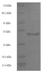 Greater than 90% as determined by SDS-PAGE.Recombinant Human U6 Snrna-Associated Sm-Like Protein Lsm4 (LSM4) Protein (His-SUMO)